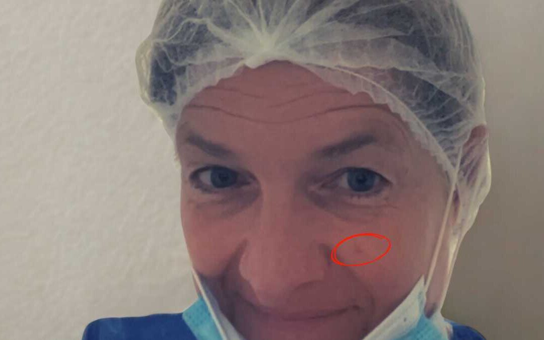 Un cancer, plus con « tumeur »